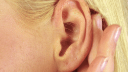 Kepçe kulak nedir, tedavisi nasıl yapılır?